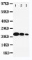 Anti-IL-6 Antibody